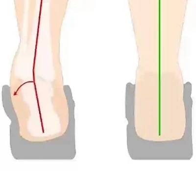 Kulno keitimo ir kulno apvertimo įvertinimas: klinikinis įvertinimas, praktiniai pritaikymai ir k...