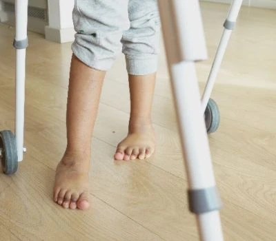 Kojų ilgio neatitikimas: disbalanso supratimas, žalos atpažinimas ir aiškumo radimas naudojant 3D...